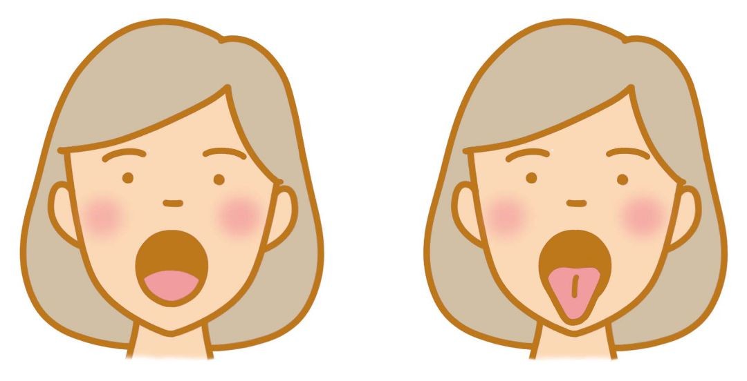 遅発性ジスキネジアと他のチック障害の比較